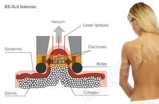 Yağ Çözme için Cryolipolysis Yağ Donma Zayıflama Makinesi Vücut Slimmer Şekillendirme Sistemi
