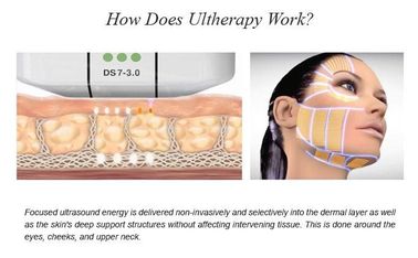 Güzellik Salonunda Yüz Tedavisi İçin Yüksek Yoğunluklu Odaklı Ultrason HIFU Güzellik Makinesi
