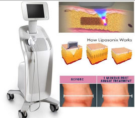 Yüksek Yoğunluklu Odaklanmış Ultrason Liposonix Zayıflama Makinesi, Ultrason Yüz Germe Makinesi