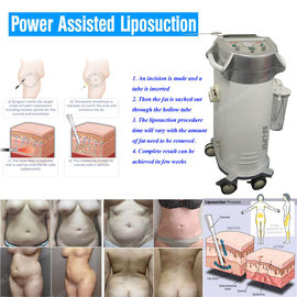 Hastane İçin Düşük Gürültülü Vücut Şekilli Güç Destekli Liposuction Ekipmanları