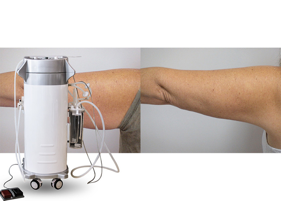 Uyluk / Silah / Sırt Arıtma İçin Güç Destekli Cerrahi Vakum Liposuction Kavitasyon Makinesi