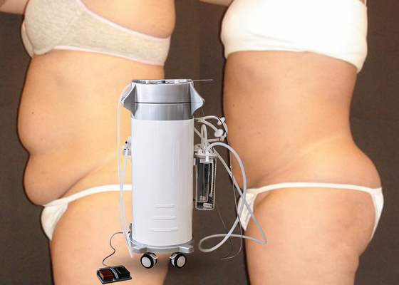Liposuction Kavitasyon Zayıflama Makinesi Güç Destekli