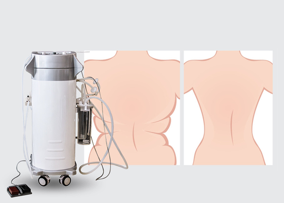 300W Giriş Gücü Cerrahi Liposuction Makinesi Lipo İnce Makine 2000ml Kapasiteli Depolama Şişesi