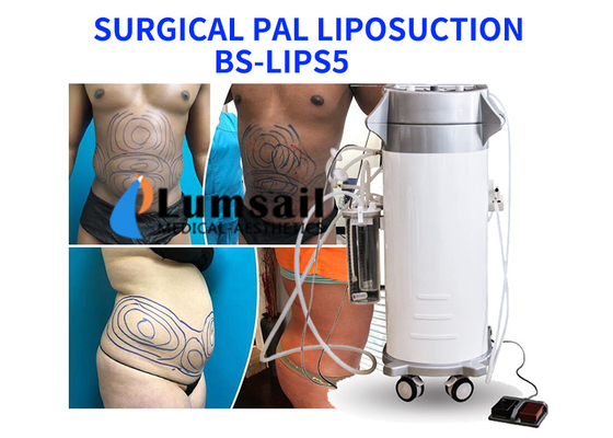 Kanül Seti ile PAL Ultrasonik Cerrahi Liposuction Makinesi Zayıflama Güzellik Ekipmanları