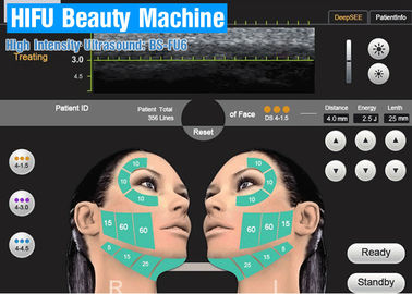 Yüz Kaldırma HIFU Güzellik Makinesi Yüksek Yoğunluklu Vajinal Sıkma Ekipmanları