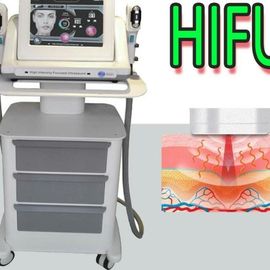 Yüz Kaldırma HIFU Güzellik Makinesi Yüksek Yoğunluklu Vajinal Sıkma Ekipmanları