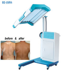 Fototerapi Tedavisi UVB Işık Terapi Makinesi, UVB Dar Bant Işık Terapisi