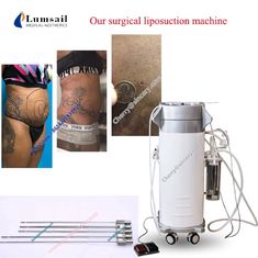 Yağ Temizleme Cerrahi Liposuction Makine Kilo Kaybı Kavitasyon Vakum Liposuction