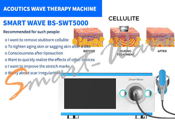 Çatlakları Giderme / Vücut Yeniden Şekillendirmek İçin 6 Verici Akustik Dalga Terapi Makinesi