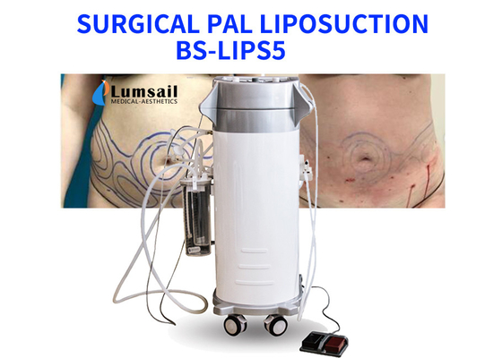 BS-LIPS5 300W Boyun Meme ve Çene için Güç Destekli Liposuction Ekipmanları