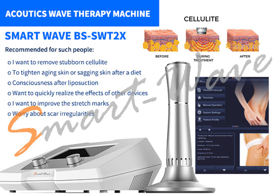 Güzellik Salonu BS-SWT2X Akustik Dalga Terapi Makine Selülit Kaldırma 1 Yıl Garanti
