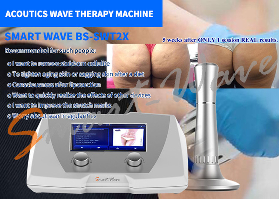 Güzellik Salonu Shockwave Terapi Cihazı Selülit Arıtma Makinesi Yüksek Verimlilik